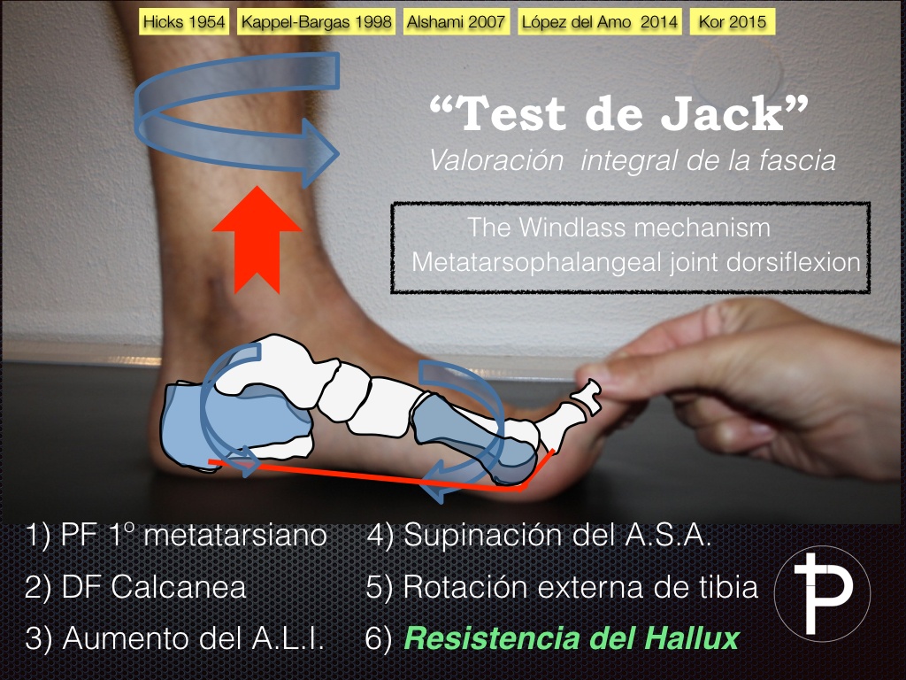 Test de Jack o maniobra de Hubscher